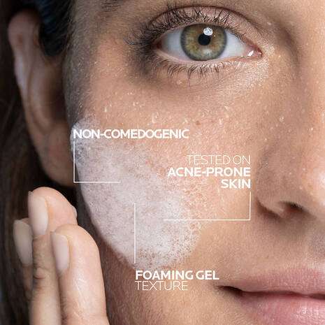 La Roche Posay Effaclar + M Purifying Foaming Gel Cleanser 200ml applied on acne-prone skin for gentle cleansing.