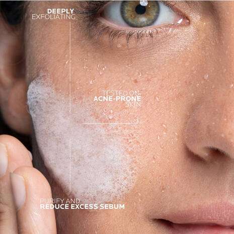 La Roche Posay Effaclar Micro-Peeling Purifying Gel Cleanser 200ml being applied to acne-prone skin for deep cleansing.