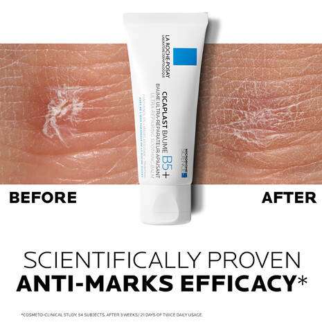 La Roche Posay Cicaplast Baume B5+ Balm Cream 100ml before and after results showing anti-marks efficacy