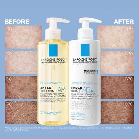 Before and after comparison of La Roche Posay Lipikar Ap+M Body Balm Cream 400ml results on dry skin.